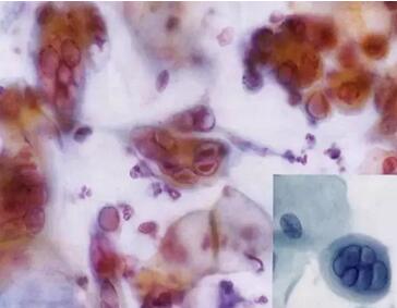 ϴӣךWMھϴOꑌҼ